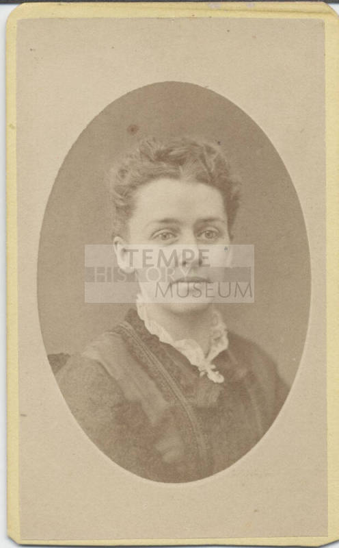 Shoulder, Woman, Lace Collar