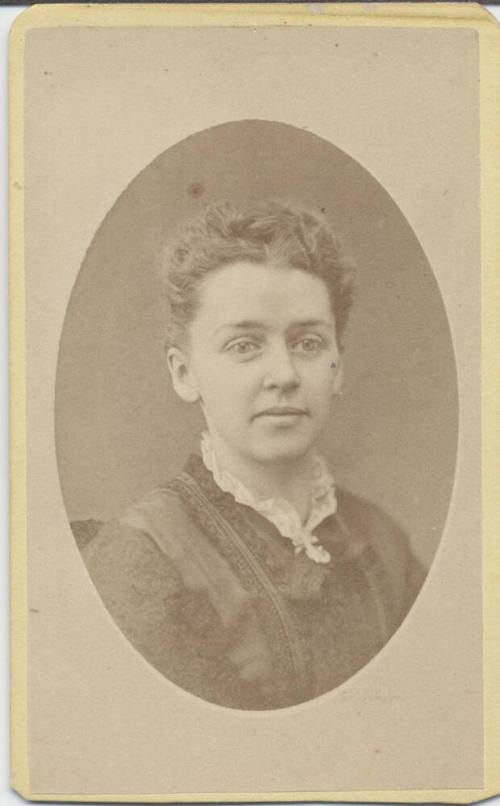 Shoulder, Woman, Lace Collar