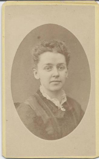 Shoulder, Woman, Lace Collar