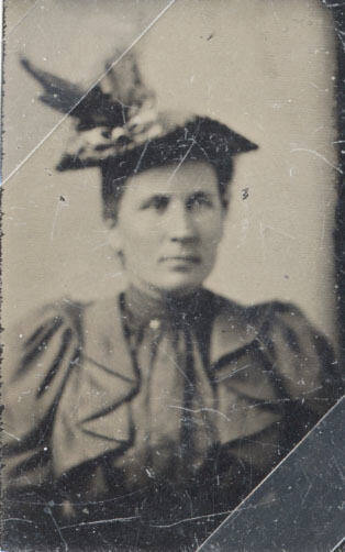Shoulder, Woman, Puffed Shoulders