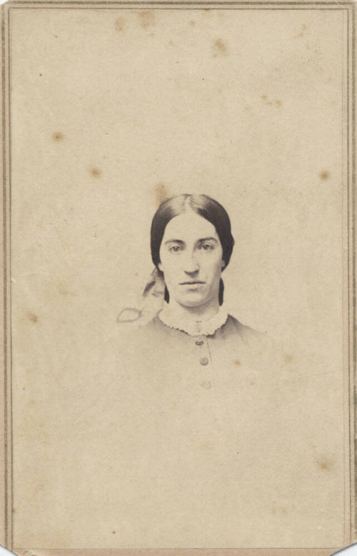 Shoulder, Women, Laced Collar