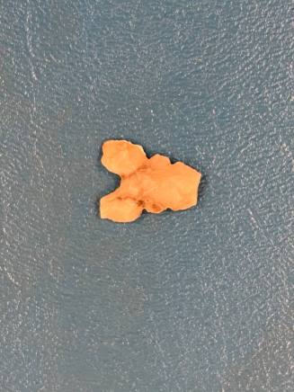 point, projectile